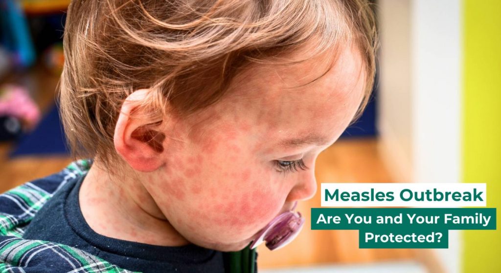 Child with Measles